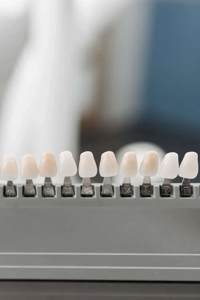 A tray of different veneer options