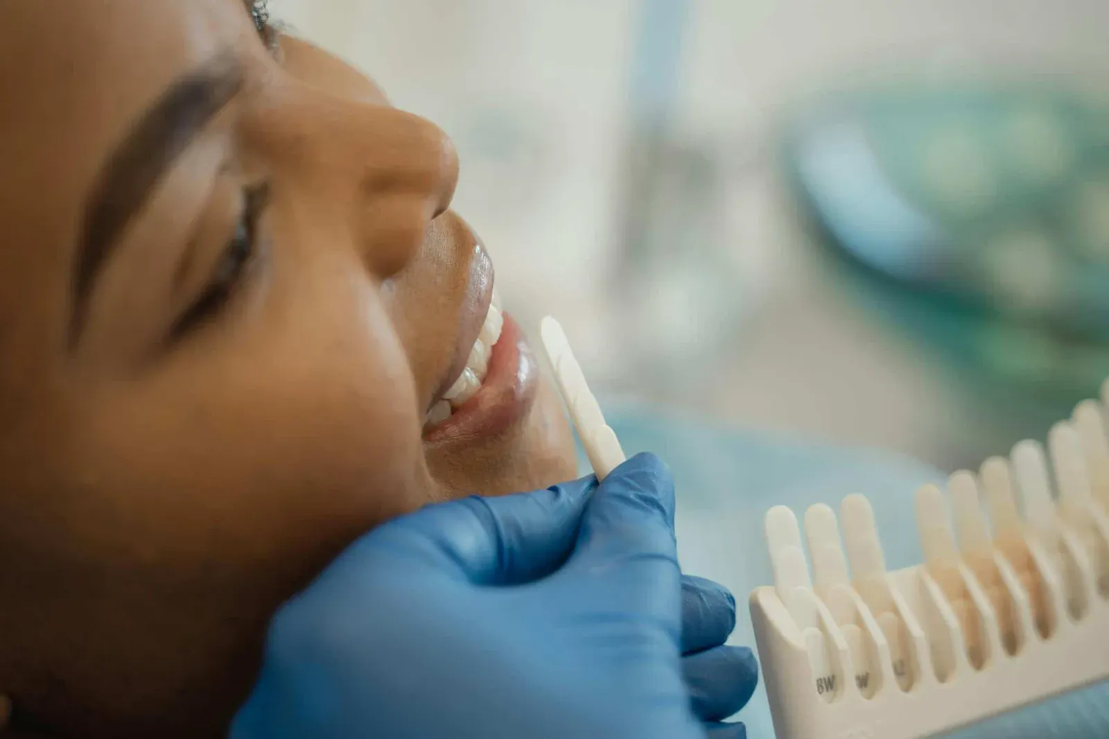 Patient smiling during a veneer consult