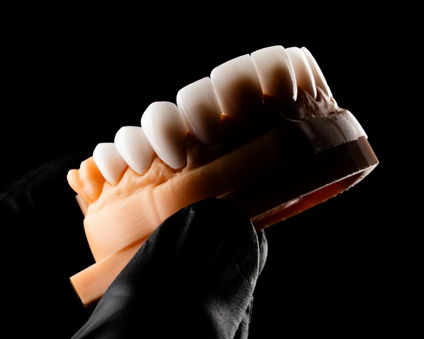 Full-arch restoration model held in a gloved hand