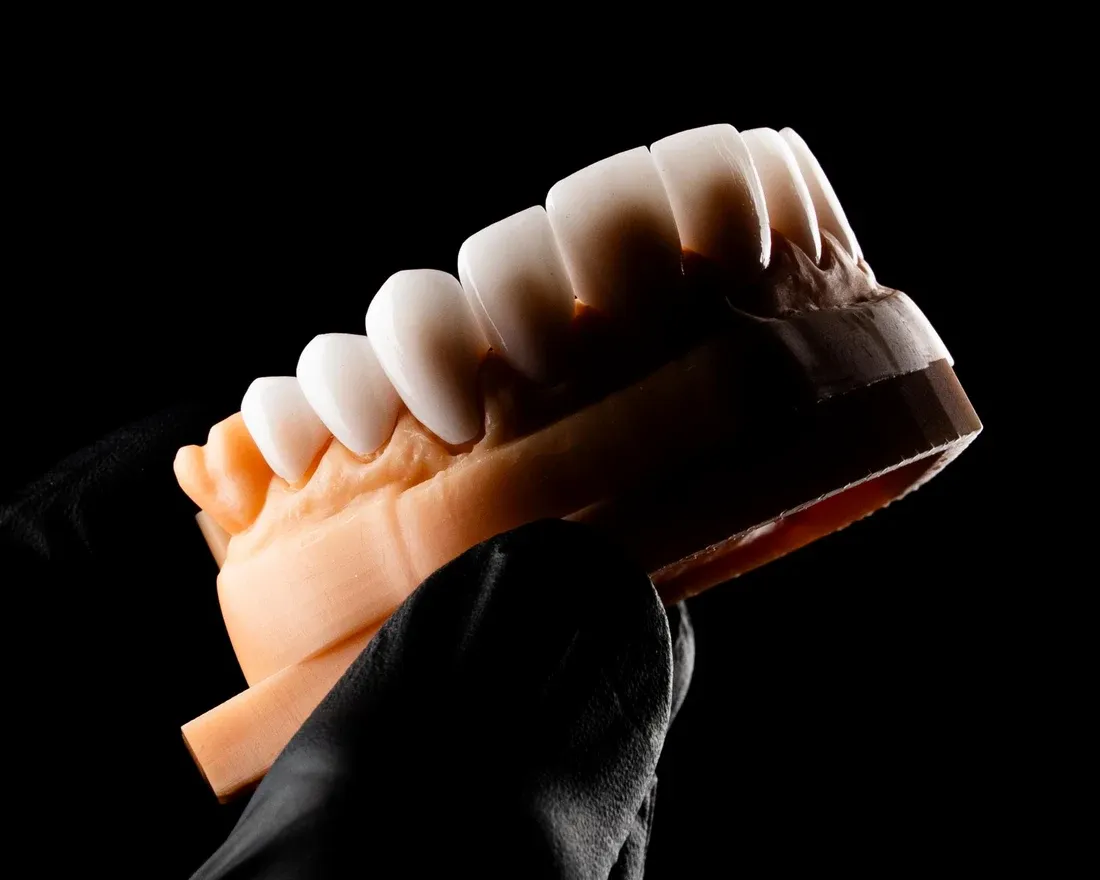 Full-arch restoration on a dental model