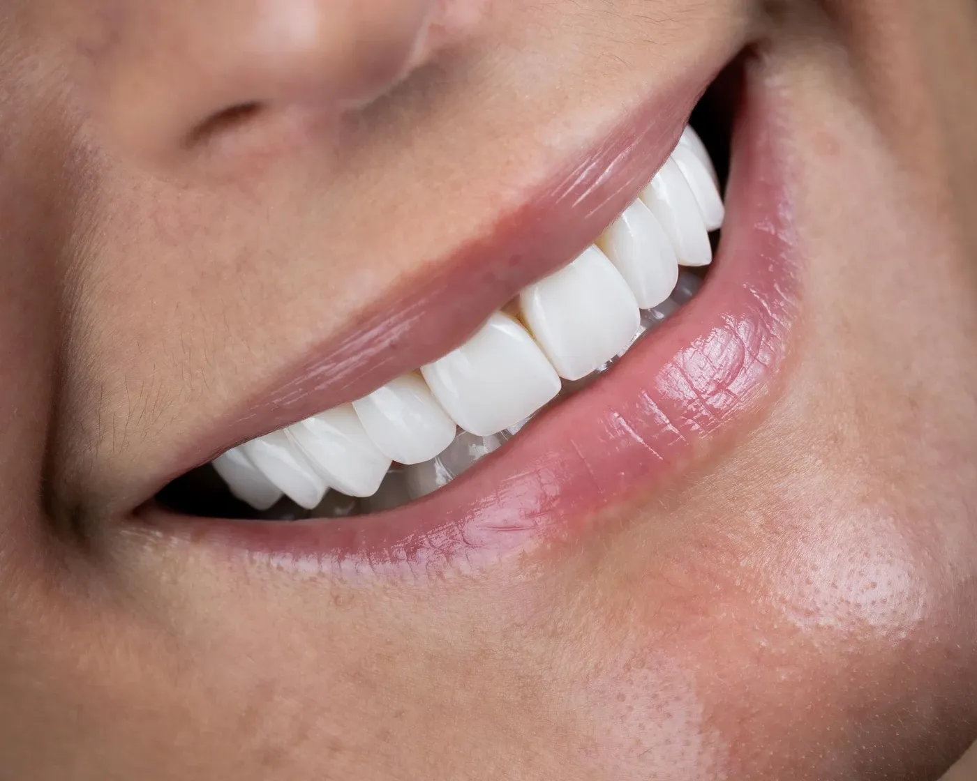 Close-up of a natural smile in daylight