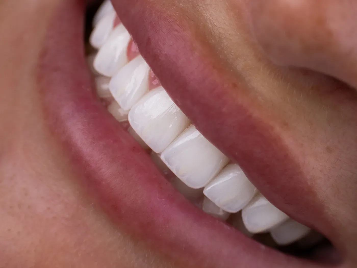 Close-up of a smile at a three-quarter angle in warm light
