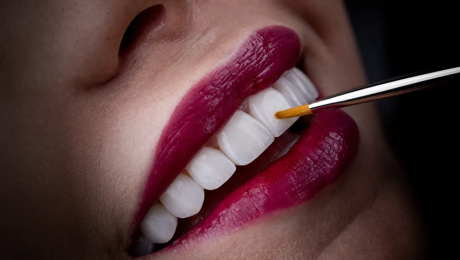 Cosmetic dentist applying a porcelain veneer with a fine brush — close-up of polished white teeth