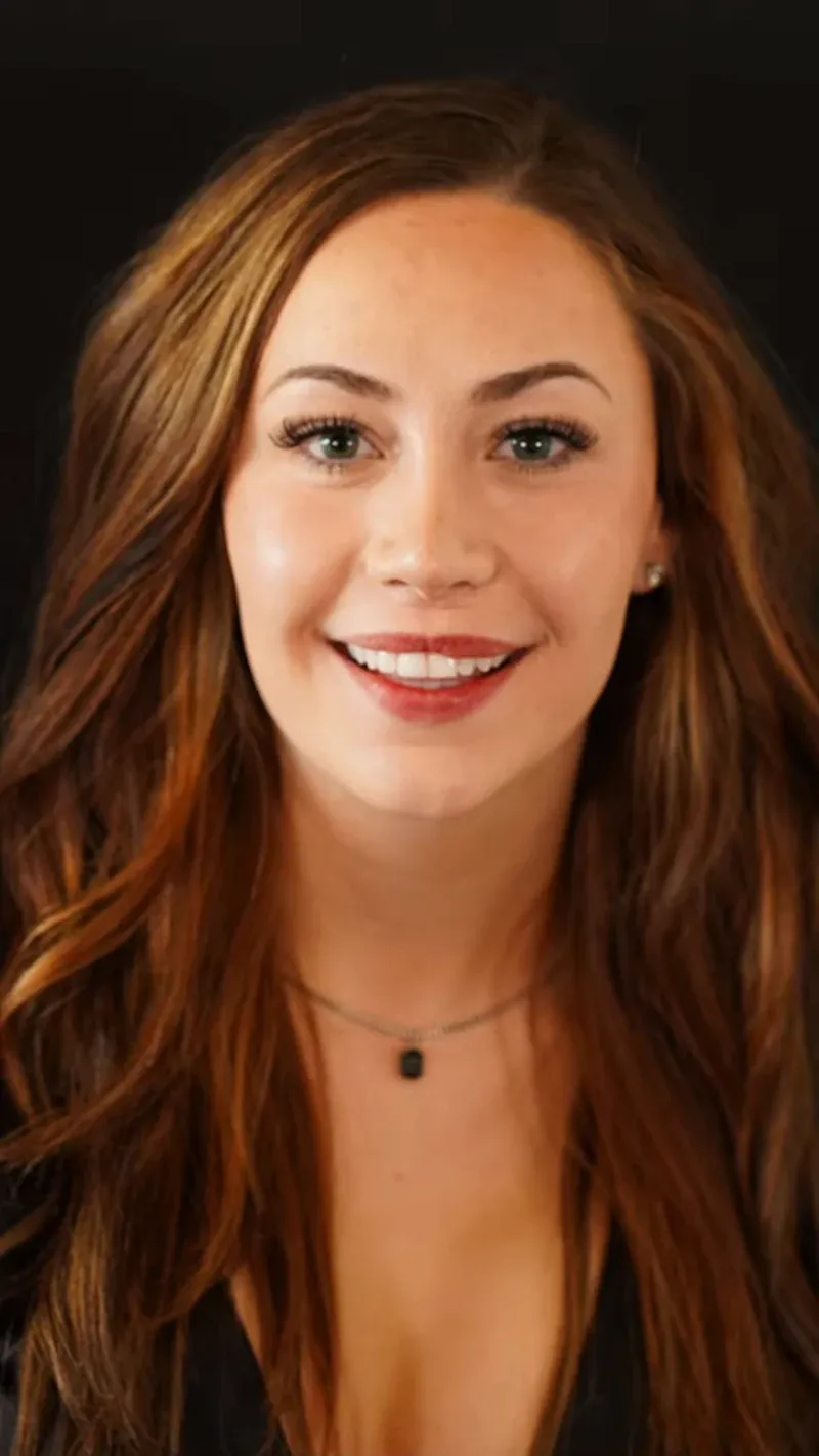 Porcelain veneers patient — close-up smile after treatment