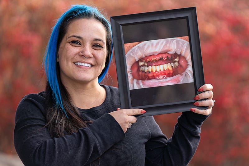 A young woman smiling next to a picture of her old damaged smile