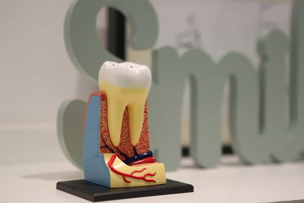 A mock up of a tooth showing the veins and nerves