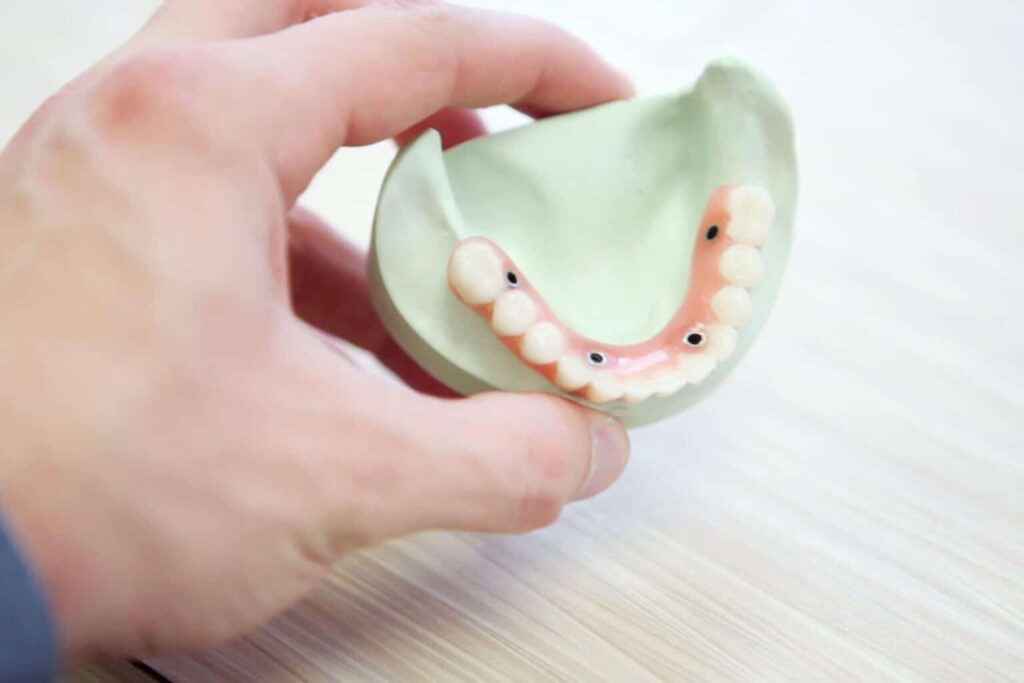 A patient holding a mock-up of all-on-4 dental implants