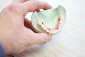 Hand holding a demonstration of all-on-4 dental implants
